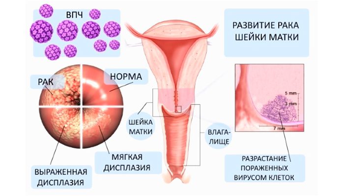 Сексуальное здоровье лесбиянок и бисексуалок